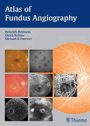 Atlas of Fundus Angiography  1st