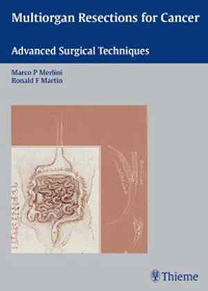 Multiorgan Resections for Cancer: Advanced Surgical Techniques  1st