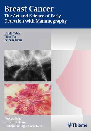Breast Cancer - The Art and Science of Early Detection with Mammography: Perception, Interpretation, Histopathologic Correlation  1st