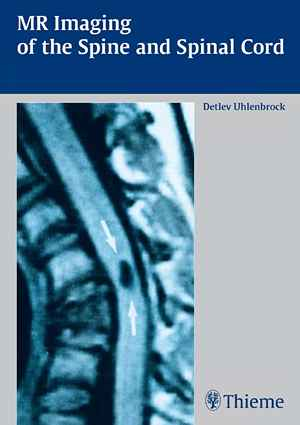 MR Imaging of the Spine and Spinal Cord  1st