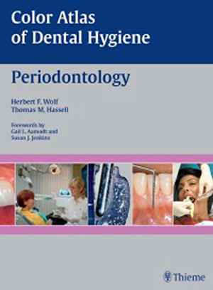 Color Atlas of Dental Hygiene: Periodontology  1st