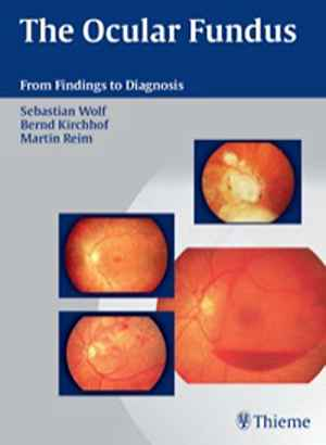 Ocular Fundus: From Findings to Diagnosis 1st
