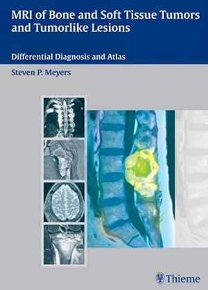 MRI of Bone and Soft Tissue Tumors and Tumorlike Lesions: Differential Diagnosis and Atlas  1st