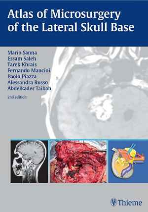 Atlas of Microsurgery of the Lateral Skull Base 2nd