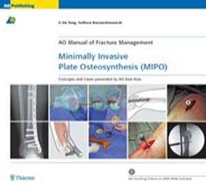 Minimally Invasive Plate Osteosynthesis (MIPO): Concepts and cases presented by the AO East Asia  1st