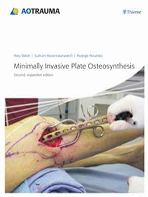 Minimally Invasive Plate Osteosynthesis (MIPO)  2nd