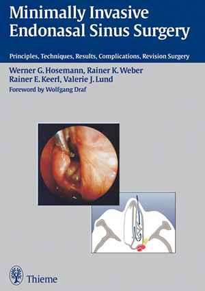 Minimally Invasive Endonasal Sinus Surgery: Principles, Techniques, Results, Complications, Revision Surgery  1st
