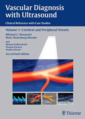 Vascular Diagnosis with Ultrasound: Clinical Reference with Case Studies Volume 1: Cerebral and Peripheral Vessels  2nd