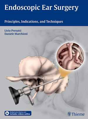 Endoscopic Ear Surgery: Principles, Indications, and Techniques  1st
