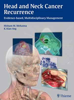 Head and Neck Cancer Recurrence: Evidence-based, Multidisciplinary Management  1st