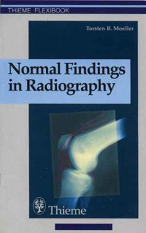 Normal Findings in Radiography 1st