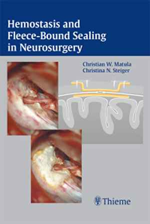 Hemostasis and Fleece-Bound Sealing in Neurosurgery 1st