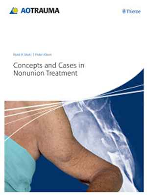 Concepts and Cases in Nonunion Treatment  1st
