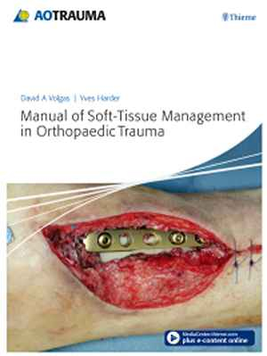 Manual of Soft-Tissue Management in Orthopaedic Trauma 1st