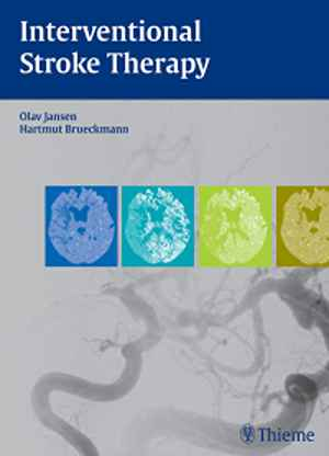 Interventional Stroke Therapy  1st
