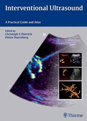 Interventional Ultrasound: A Practical Guide and Atlas  1st