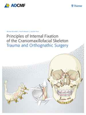 Principles of Internal Fixation of the Craniomaxillofacial Skeleton: Trauma and Othognathic Surgery 1st