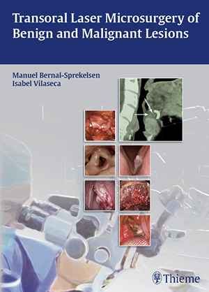 Transoral Laser Microsurgery of Benign and Malignant Lesions 1st