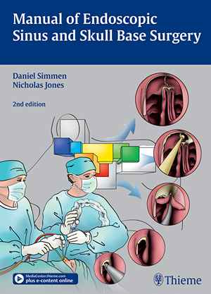 Manual of Endoscopic Sinus and Skull Base Surgery  2nd