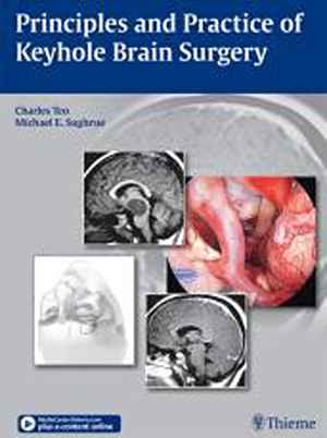 Principles and Practice of Keyhole Brain Surgery 1st