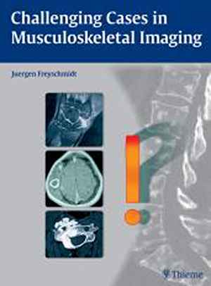 Challenging Cases in Musculoskeletal Imaging  1st