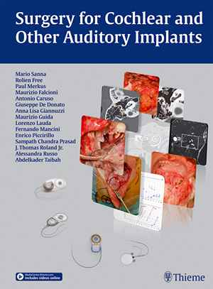 Surgery for Cochlear and Other Auditory Implants  1st
