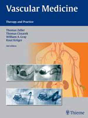 Vascular Medicine: Therapy and Practice 1st