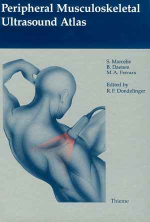 Peripheral Musculoskeletal Ultrasound Atlas