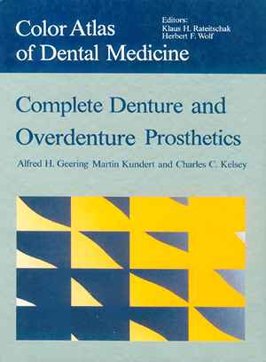 Complete Denture and Overdenture Prosthetics