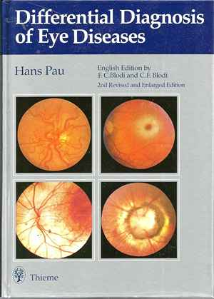Differential Diagnosis of Eye Diseases