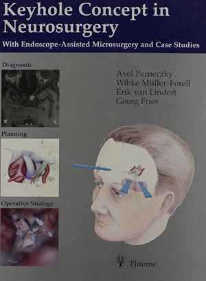 Keyhole Concept in Neurosurgery: With Endoscope-Assisted Microsurgery and Case Studies