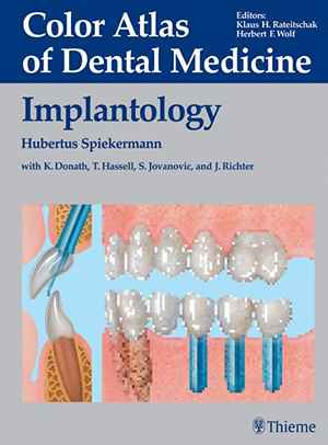 Implantology (Color Atlas of Dental Medicine)