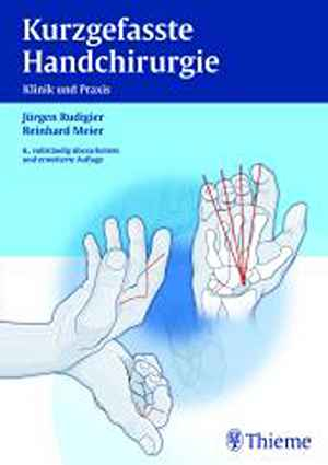 Kurzgefasste Handchirurgie