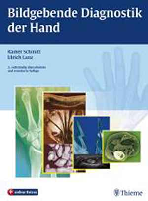 Bildgebende Diagnostik der Hand