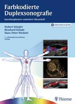 Farbkodierte Duplexsonografie