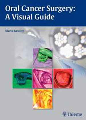 Oral Cancer Surgery: A Visual Guide 1st