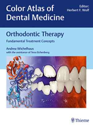 Orthodontic Therapy: Fundamental Treatment Concepts  1st