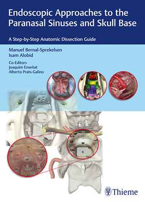 Endoscopic Approaches to the Paranasal Sinuses and Skull Base: A Step-by-Step Anatomic Dissection Guide  1st