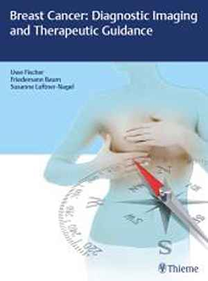 Breast Cancer: Diagnostic Imaging and Therapeutic Guidance 1st