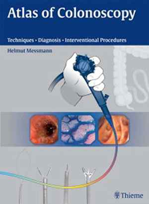 Atlas of Colonoscopy: Techniques - Diagnosis - Interventional Procedures 1st