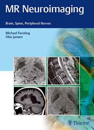 MR Neuroimaging: Brain, Spine, Peripheral Nerves  1st