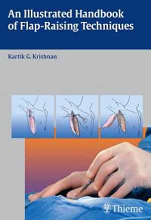 An Illustrated Handbook of Flap-Raising Techniques 1st