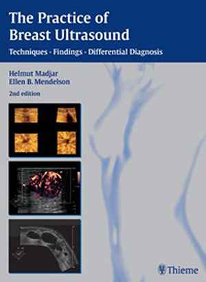 The Practice of Breast Ultrasound: Techniques, Findings, Differential Diagnosis 2nd