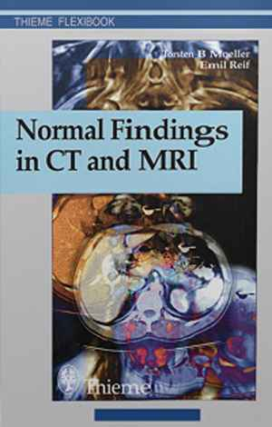 Normal Findings in CT and MRI 1st