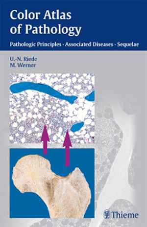 Color Atlas of Pathology: Pathologic Principles, Associated Diseases, Sequela 1st