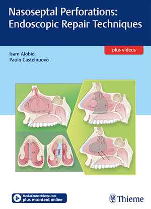 Nasoseptal Perforations: Endoscopic Repair Techniques 1st