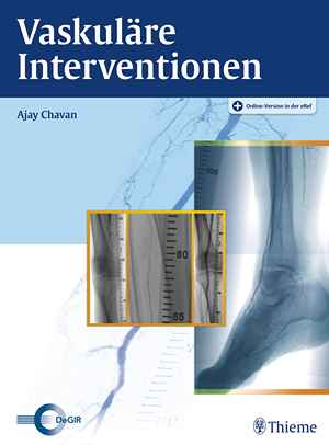 Vaskuläre Interventionen