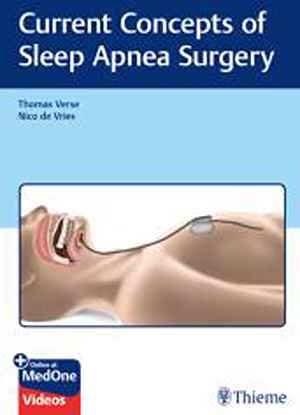 Current Concepts of Sleep Apnea Surgery  1st