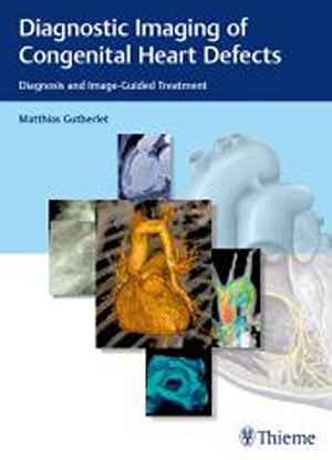 Diagnostic Imaging of Congenital Heart Defects: Diagnosis and Image-Guided Treatment  1st