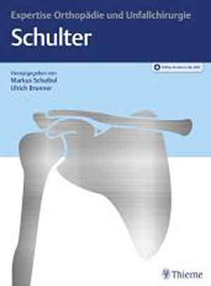 Expertise Schulter